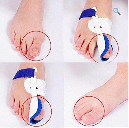 Bunion Corrector Splint Brace Adjustable Hinged Big Toe Straightener - Best Compression Socks Sale